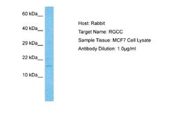 RGC32 Antibody, Novus Biologicals 100 &mu;L | Buy Online | Novus Biologicals | Fisher Scientific